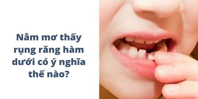 Một vài tình huống nằm mơ thấy rụng răng dễ bắt gặp nhất