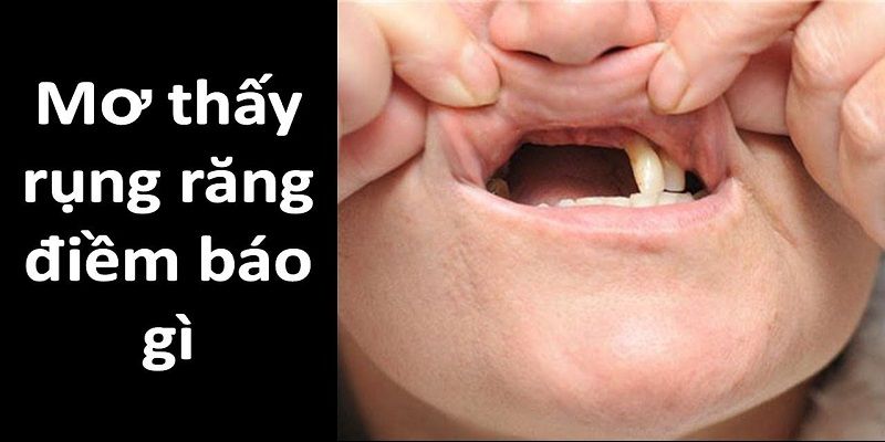 Giải mã ý nghĩa của tình huống nằm mơ thấy rụng răng